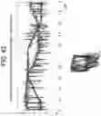 Fig. 49 - Methods and kits for assessing central nervous system integrity
