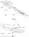 Fig. 08 - Retractor blade devices and related methods