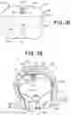 Fig. 02 - SEMISPHERICAL BRAIDED ANEURYSM TREATMENT SYSTEM AND METHOD