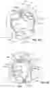 Fig. 18 - SEMISPHERICAL BRAIDED ANEURYSM TREATMENT SYSTEM AND METHOD