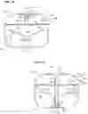 Fig. 19 - SEMISPHERICAL BRAIDED ANEURYSM TREATMENT SYSTEM AND METHOD
