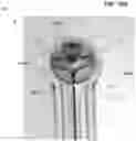 Fig. 23 - SEMISPHERICAL BRAIDED ANEURYSM TREATMENT SYSTEM AND METHOD