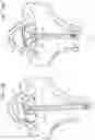 Fig. 29 - SEMISPHERICAL BRAIDED ANEURYSM TREATMENT SYSTEM AND METHOD