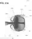 Fig. 34 - SEMISPHERICAL BRAIDED ANEURYSM TREATMENT SYSTEM AND METHOD