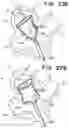 Fig. 42 - SEMISPHERICAL BRAIDED ANEURYSM TREATMENT SYSTEM AND METHOD