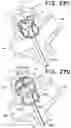 Fig. 43 - SEMISPHERICAL BRAIDED ANEURYSM TREATMENT SYSTEM AND METHOD