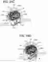 Fig. 51 - SEMISPHERICAL BRAIDED ANEURYSM TREATMENT SYSTEM AND METHOD