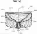 Fig. 57 - SEMISPHERICAL BRAIDED ANEURYSM TREATMENT SYSTEM AND METHOD