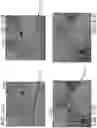 Fig. 60 - SEMISPHERICAL BRAIDED ANEURYSM TREATMENT SYSTEM AND METHOD