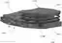 Fig. 01 - Mechanical ligament balancing devices