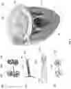Fig. 02 - PAPILLARY MUSCLE APPROXIMATION AND VENTRICULAR RESTORATION