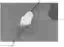 Fig. 01 - ORBITAL FLOOR IMPLANT
