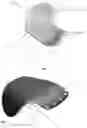 Fig. 03 - ORBITAL FLOOR IMPLANT