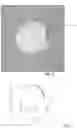 Fig. 04 - ORBITAL FLOOR IMPLANT