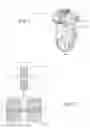 Fig. 02 - SPACER UNIT FOR USE IN A MOVABLE JOINT OF A PROSTHETIC OR ORTHOPEDIC SYSTEM