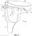 Fig. 07 - ANTERIOR LOCKING CLIP