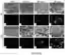 Fig. 08 - Medical and Dental Bioceramic Composition for Temporary Use