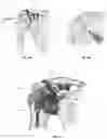 Fig. 02 - Guiding musculoskeletal procedures