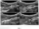 Fig. 09 - Guiding musculoskeletal procedures
