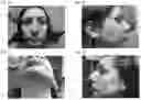 Fig. 02 - DERMATOLOGICAL FORMULATIONS FOR TREATMENT OF DERMATITIS