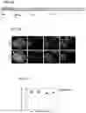 Fig. 02 - METHOD FOR GENERATING A THREE-DIMENSIONAL NEUROMUSCULAR ORGANOID IN VITRO
