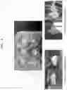 Fig. 09 - Thermosensitive chitosan hydrogel composition and bioink composition comprising the same