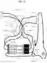 Fig. 25 - BLOOD PROCESSING  APPARATUS,  DISPOSABLE SET, METHOD, AND SYSTEM