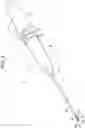 Fig. 02 - CATHETER ASSEMBLY