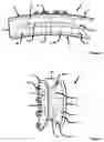 Fig. 03 - INTRACORPOREAL GUIDE COMPONENT