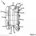 Fig. 04 - INTRACORPOREAL GUIDE COMPONENT
