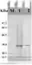 Fig. 01 - Acid phosphatase mutants and methods of using the same