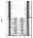 Fig. 02 - METHODS AND MATERIALS FOR ASSESSING ALLELIC IMBALANCE