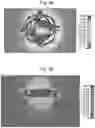 Fig. 09 - RADIOFREQUENCY COIL