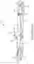 Fig. 13 - RESTRAINT FOR HUMANE TREATMENT OF DETAINEE AND METHOD OF USING THE SAME