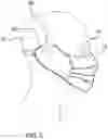Fig. 06 - Sanitary Face Mask Assembly