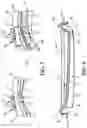 Fig. 04 - Container with internal glass receptacle and method for assembling the container by using a spacing and locking insert