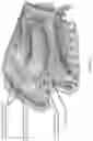 Fig. 49 - NON-INVASIVE PROPRIOCEPTIVE STIMULATION FOR TREATING EPILEPSY