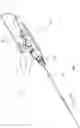 Fig. 02 - Apparatus and method for sealing a vascular puncture