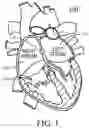 Fig. 02 - SYSTEMS, DEVICES, AND METHODS FOR DIAGNOSING AMYLOIDOSIS