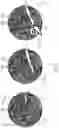 Fig. 06 - Surgical microscope with gesture control and method for a gesture control of a surgical microscope