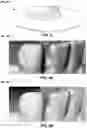 Fig. 07 - Systems and methods for forming a dental appliance