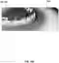 Fig. 09 - Systems and methods for forming a dental appliance