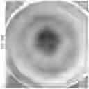 Fig. 85 - Prosthetic capsular devices, systems, and methods