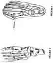 Fig. 02 - Orthopedic device providing metered toe traction with variable adduction, dorsiflexion and rotation angles, including lateral glide of the first metatarsal head
