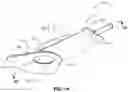 Fig. 02 - Fluid collection assemblies including at least one securement body