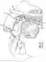 Fig. 07 - Eustachian tube dilation balloon with ventilation path