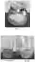 Fig. 02 - FORMULATIONS AND METHODS FOR DRUG INSTILLATION INTO THE BLADDER AND TREATMENT OF BLADDER AILMENTS