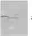 Fig. 09 - Maximizing Distribution and Minimizing Washout of Injectates in Bone and Method for Enhanced Aspirate Extraction