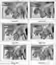Fig. 20 - HIGH MOLECULAR IODINE CONCENTRATION COMPOSITIONS, PHARMACEUTICAL FORMULATIONS, PREPARATION AND USES