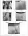 Fig. 22 - HIGH MOLECULAR IODINE CONCENTRATION COMPOSITIONS, PHARMACEUTICAL FORMULATIONS, PREPARATION AND USES